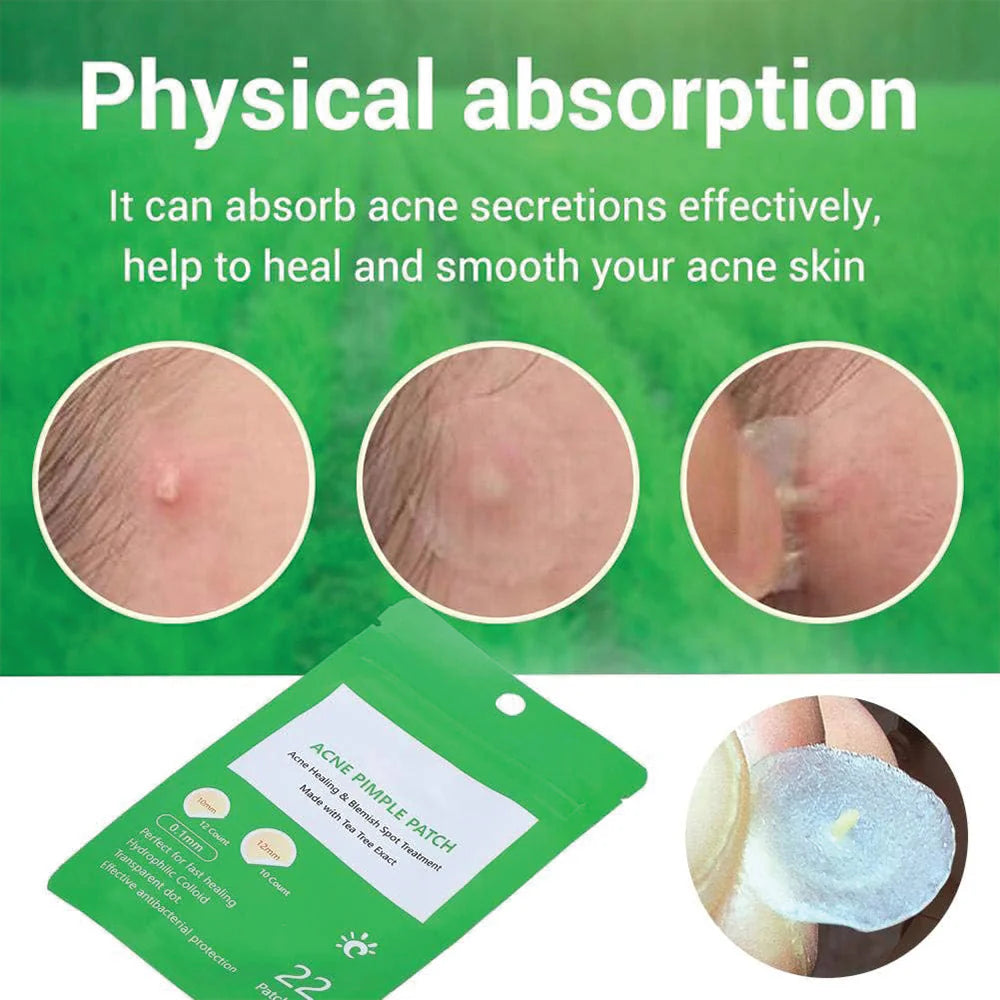 Patch Pimple Button Remove Patch Corrector, Anti Acne For Make-Up 22 Patches\kq146