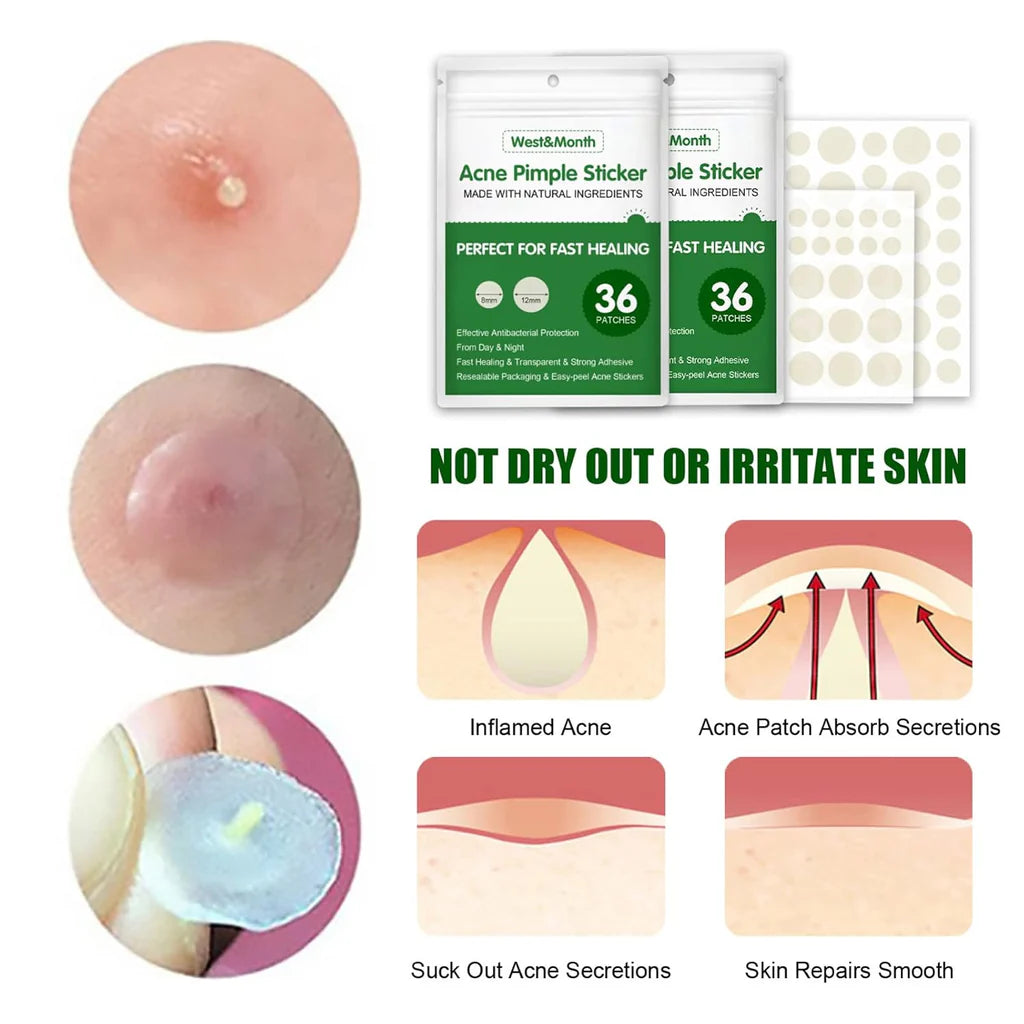 Ketsicart Transparent Invisible Acne Remover/kq256