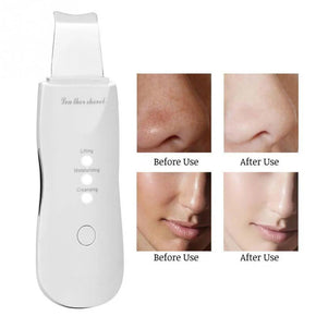 Skin Clean Machine Peeling Removes Facial Beauty Skin Scrubber/KN-276