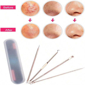 4pcs/Set Blackhead Acne Needle Skin Care Tool\kq015