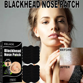 Nose Patch Pore 10 Pcs/kq282