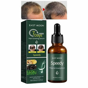 Hair Growth Essential Oil 30ml/kq301