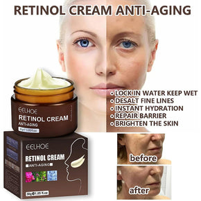 Retinol Anti Aging Wrinkle Removal Skin Firming Cream 30G/kq263