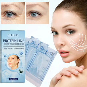 Collagen Thread Lifting, Active Collagen Facial Silk Thread Lifting Face 5 Pcs/kq268