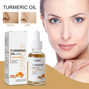 Turmeric Dark Spot Corrector Serum 30 ML/kq243